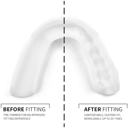 SOVA 3D Night Guard - 2.0mm Thin - Custom-Molded Fit - Protects Against Nighttime Teeth Grinding & Clenching - FSA/HSA Eligible - Odor & Taste Free - Remoldable Up to 20 Times - Non Toxic