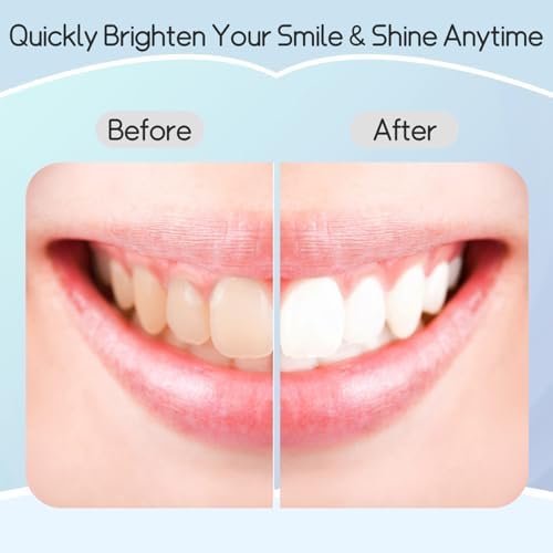 Teeth Whitening Strips Professional Effects Plus, Tooth Whitening Strips Safe Formulas Stain Removal, Deep Cleanse 7 Treatments, Suitable for Sensitive Teeth, Coffee, Smoke Stains