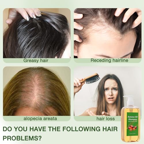 Shampoo De Batana, Rosemary Oil Shampoo,Batana Shampoo,Batana Shampoo with Rosemary Extract, Shampoo De Batana Para La Caida Del Cabello, Nourishing & Regenerating Hair-Soft and Fluffy for Men & Women