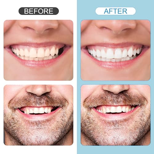 Tooth Repair Kit,Temporary Natural Shade for Filling The Gap, Moldable Thermal Beads Replacement Kit Replace The Missing or Broken Tooth-6PCS-D33
