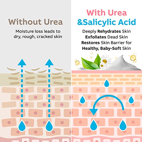 Urea Cream 40 Percent for Feet Maximum Strength, Urea Foot Cream for Dry Cracked Heels Feet Knees Elbows, 40% Urea Foot Repair Lotion 5.3 OZ