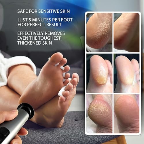 Electric Foot Callus Remover Rechargeable - Black Electric Foot Filer with 9 Speed Settings, Type-C Charging, and 60 Sanding Discs for Smooth Skin - Callus Remover for Feet