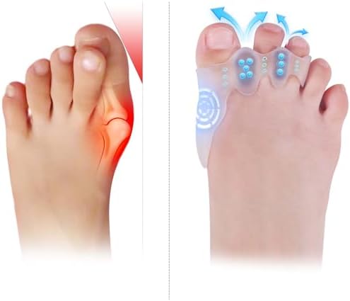 Toe Spacers & Bunion Corrector for Kids | Toe Separators,Corn Callus Removers|Hammer Toe Straightener|Bunion Relief|Overlapping Toes Separators|Corn Pads for Toes|1 Pair (Small-Kids)
