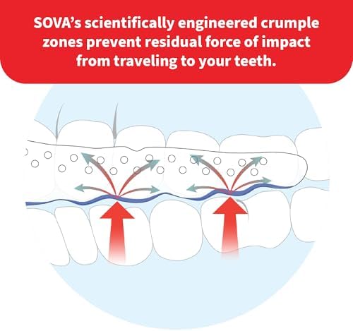 SOVA Max Night Guard - 2.4mm Thin - Custom-Molded Fit - Protects Against Nighttime Teeth Grinding & Clenching - FSA/HSA Eligible - Odor & Taste Free - Remoldable Up to 20 Times - Non Toxic