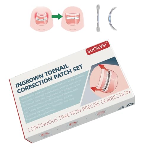 Titanium Alloy Ingrown Toenail, Ingrown Nail, Big Foot Toenail Removal Kit, Applicable for Any Size, Nail Correction Patch and Retainer (0.59/0.67/0.79in)