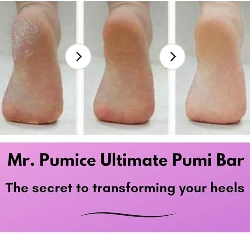 Mr. Pumice Ultimate PUMI Bar: 2-in-1 Dual-Grit (Medium + Coarse) Callus Remover, Pedicure Stone & Ped File Scrubber for Smooth Feet and Heels, (12-Count Display Box)