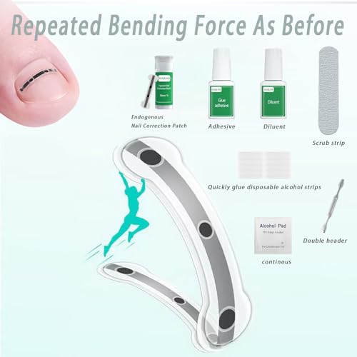 Titanium Alloy Ingrown Toenail, Ingrown Nail, Big Foot Toenail Removal Kit, Applicable for Any Size, Nail Correction Patch and Retainer (0.59/0.67/0.79in)