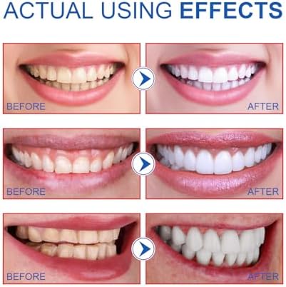SP-6 Probiotics Whitening Toothpaste, Ultra Whitening Toothpaste – Enamel Safe Formula for Sensitive Teeth, Mint Freshness, Fresh Breath, 100g (4.23 Ounce, Mint)