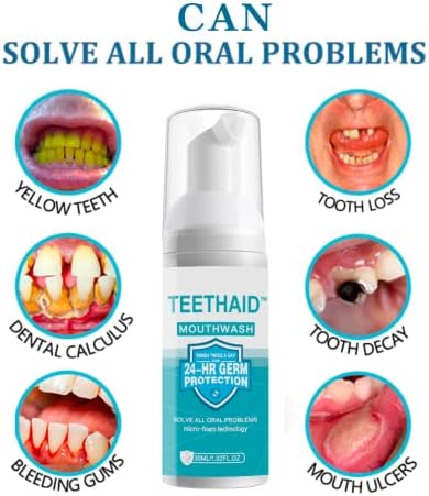 | Teeth Whitening Toothpaste & Mouthwash | Whitener Travel & Kids Toothpaste | Fluoride Free for Adults | Tooth Repair Kit Similar to His Smile & My Smile
