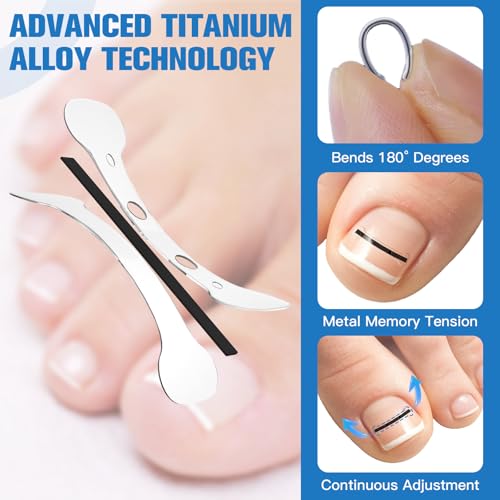 Titanium Alloy Ingrown Toenail Treatment, Ingrown Toenail Removal Kit for Curved Nail Repair, Ingrown Nail Tool for Home Use