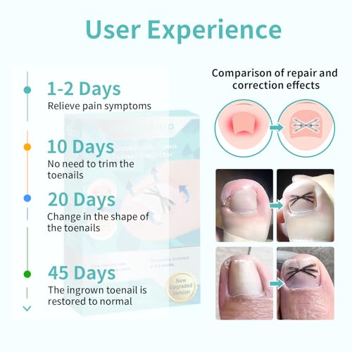 Upgraded Titanium Alloy Ingrown Toenail Corrector with Upgraded 6-Angle Shape,3x Stronger Pull Force,Ingrown Toenail Removal Kit, Ingrown Toenail Treatment for Women and Man (Large Size-6 Packs)