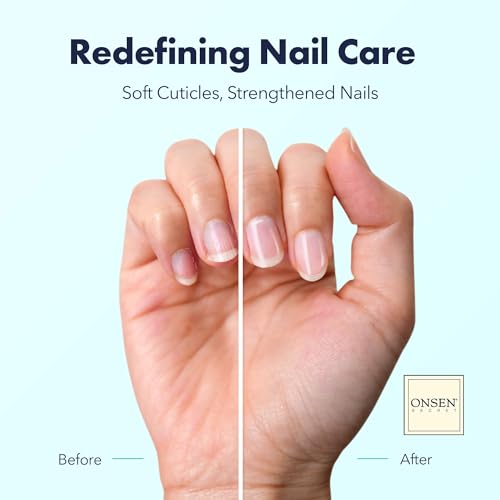 Onsen Secret Nail & Cuticle Repair Oil (30ml) - Dry Oil Formula - Japanese Tsubaki, Tea Tree & Jojoba - Strengthens Nails, Repairs Cuticles, Hydrates Skin & Hair - Natural & Vegan