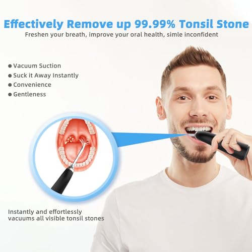Voraiya Electronic Tonsil Stone Remover Vacuum, 10 in 1 Tonsil Removal Kit, 5 Modes Cleaner, Instant Suction Tool, Easy to Use, Fight Bad Breath, Mouth Cleaning Oral Care (Black)