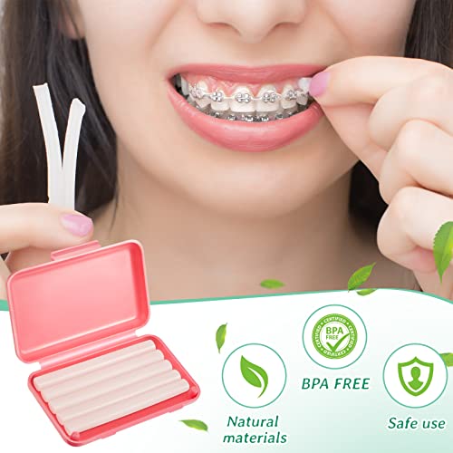 Tondiamo 40 Pack Clear Braces Wax for Teeth Dental Wearer Orthodontic Tooth Wax for Braces and Oral Appliances with Colorful Storage Case and Smell(Mixed Flavors)