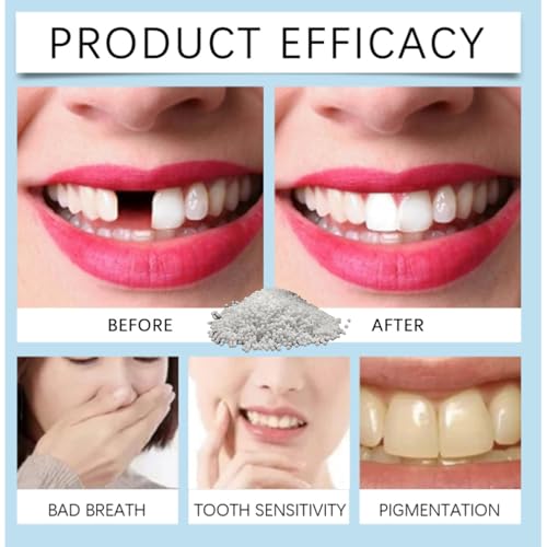Tooth Repair Kit, Moldable Tooth Filling Repair Kit Beads with 3 Dental Tool, Moldable False Teeth Beads The Missing and Broken Replacements, DIY Natural Filling Fake Teeth,Smile Confidently Again