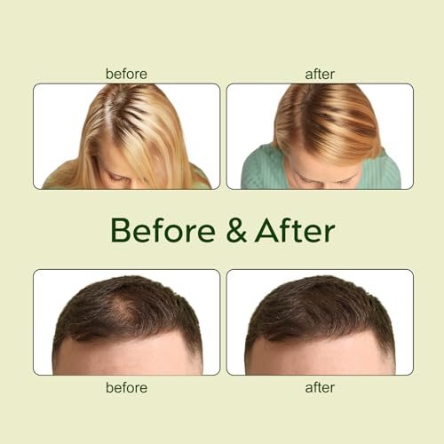 Veganic Natural Hair Growth Oil, Vegnaic Hair Growth Oil for Hair 30ml x 2pcs.