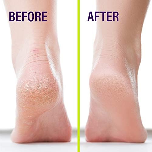 The #1 Liquid Skin Protectant for Cracked Heels, Cracked Feet Treatment, Liquid Bandage, Must-Have Foot Care for Cracked Feet, Calluses, Blisters, Foot Repair, Applicator and Buffer, 1Pk