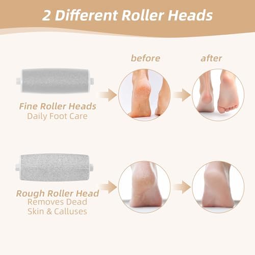 Electric Foot Callus Remover, Electronic Foot File, Portable Electric Callus Remover for Feet, Pedicure Tools for Dead Skin Calluses