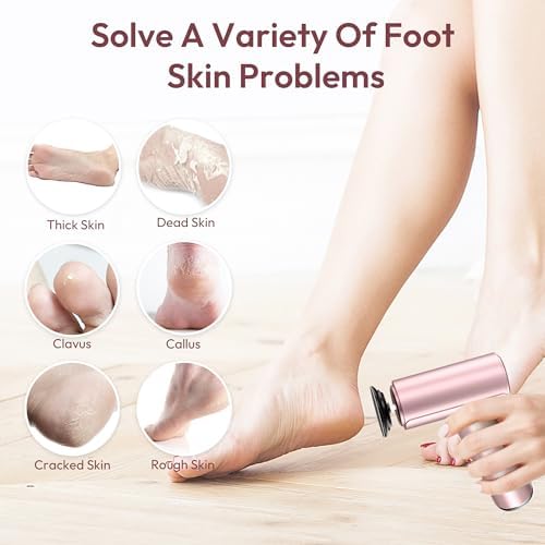 Electric Callus Remover for Feet, Rechargeable Electric Foot Callus Remover Pedicure Tool with 70pcs Sandpapers, Professional Foot File for Dead Skin, Calluses - Pink
