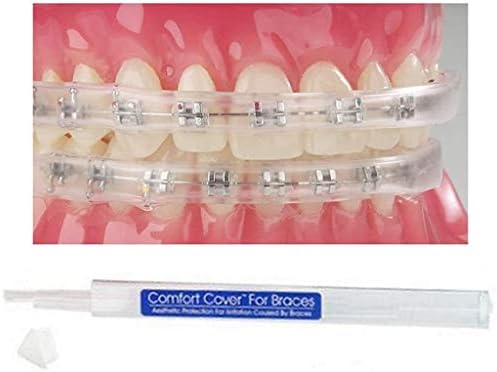 Sonic Dental - Comfort Guard/Lip Shield/Mouth Guard - for Braces - Orthodontic - Dental