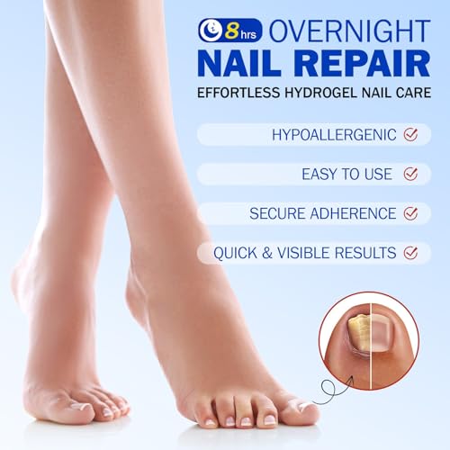 Toenail Fungus Treatment Extra Strength Nighttime Renewal Fungal Nail Patches - 21 Patch - Overnight Repair for Nail Fungus Damage, 8-Hour Treatment Restores Healthy Appearance (21 Count (Pack of 3))