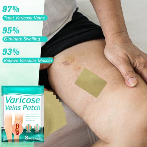 2pc Varicose Veins Treatment for Legs – Professional Varicose Veins Cream & Patch, Naturally Improves Leg Appearance
