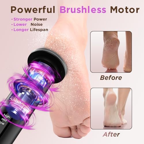 Electric Foot Callus Remover with 2600mAh Battery, Brushless Callus Remover for Feet with Nano-Glass Head & 60 Pcs Sandpaper Discs, Electric Foot File with 3 Adjustable Speeds, Gifts for Women