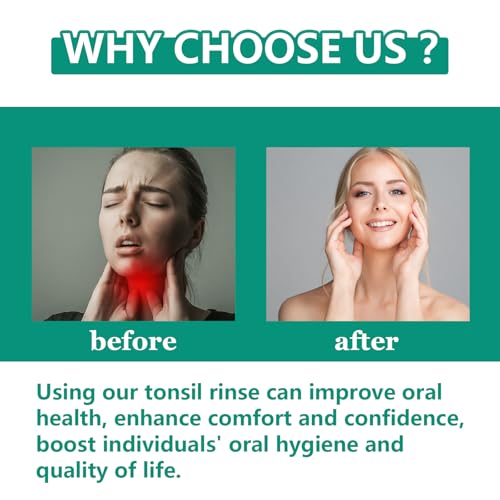 Tonsil Stone Remover with Oral Rinse Liquid to Soothe Tonsils, and Freshen Breath & Alcohol-Free – 300ml (10.14 fl oz)