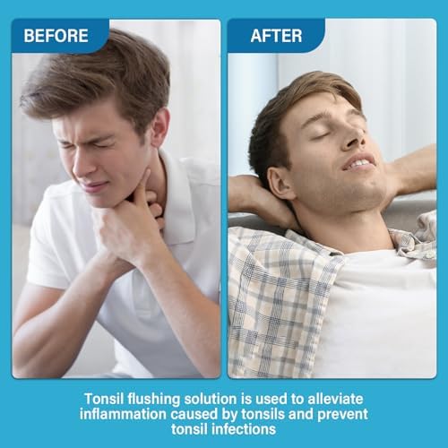 Tonsil Stone Remover, Natural Ingredients Mouthwash or Oral Rinse Liquid to Help Soothe Tonsils, Fast Effectively Soothe Dry Mouth & Freshens Breath Tonsil Stone Mouthwash, Smell Fresh