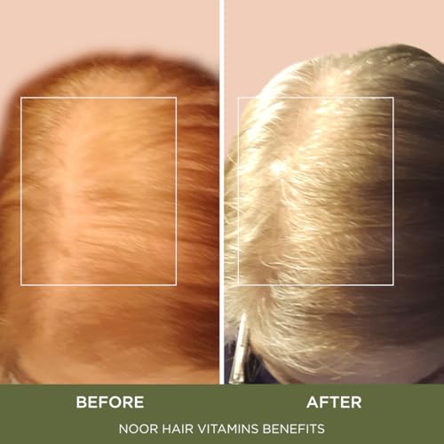 NOOR HAIR Healthy Hair Formula, Hair Growth Supplement Supporting Thick Hair and Fast Hair Regrowth. Vitamin C, B6, Zinc, Propietary Non-GMO & Gluten Free Womens Hair Loss Vitamins - 30 Day Supply