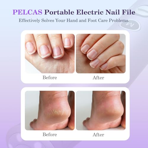 PELCAS Electric Nail Drills, 10 Speeds Cordless Nail File with LED Light, Portable Manicure & Pedicure Kit, Nail Grinder with LCD Screen for Human, Pet, Thick Toenails, Natural & Acrylic Nails Purple