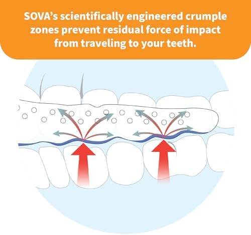 SOVA Junior Night Guard, Purple Punch - 1.6mm Thin - Custom-Molded Fit - Protects Against Nighttime Teeth Grinding & Clenching - FSA/HSA Eligible - Odor & Taste Free - Remoldable Up to 20 Times