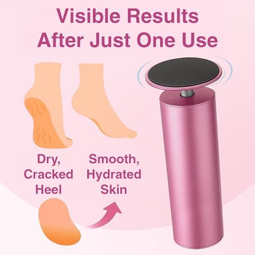 Electric Foot Callus Remover | Feet Filer Sander File Tool Grinder Heavy Duty Scrubber Shaver Buffer Smoother Drill Pedicure Dead Skin Cracked Heels Calluses 60 pcs Sandpaper Discs by VISOFO