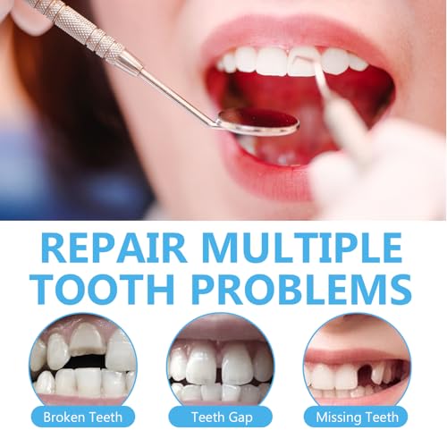 Tooth Repair Kit, Moldable Tooth Repair Kit for Broken Teeth Fixing & Missing Teeth Replacement, Safe & Effective Kit with 4 Dental Tools and 30 ml Repair Beads (Blue)