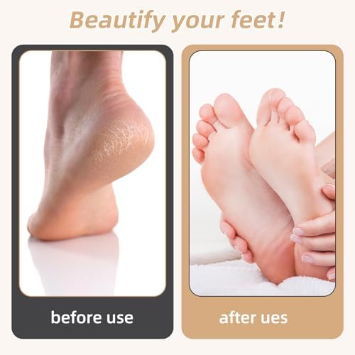 Electric Foot Callus Remover, Electronic Foot File, Portable Electric Callus Remover for Feet, Pedicure Tools for Dead Skin Calluses
