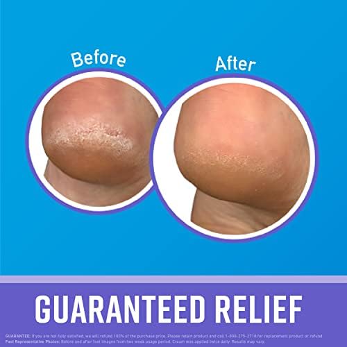 O'Keeffe's Working Hands Night Treatment Hand Cream and Healthy Feet Night Treatment Foot Cream, 7 Ounce Tube