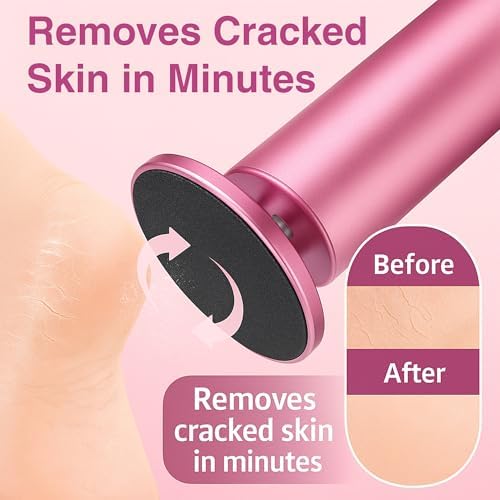 Electric Foot Callus Remover | Feet Filer Sander File Tool Grinder Heavy Duty Scrubber Shaver Buffer Smoother Drill Pedicure Dead Skin Cracked Heels Calluses 60 pcs Sandpaper Discs by VISOFO