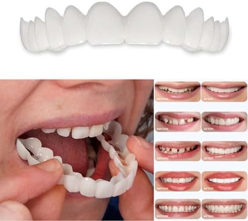 2 Pairs, Temporarily Adjustable for Men and Women, Regain Confidence(Beige)