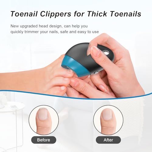 Electric Nail Clipper, Upgraded Toe Nail Clippers with Nail Scraps Storage, 2 Speeds, Magnetic Cover, Type-C Rechargeable, Safety Electric Nail File for Thick Toenails, Adult, Seniors, Men