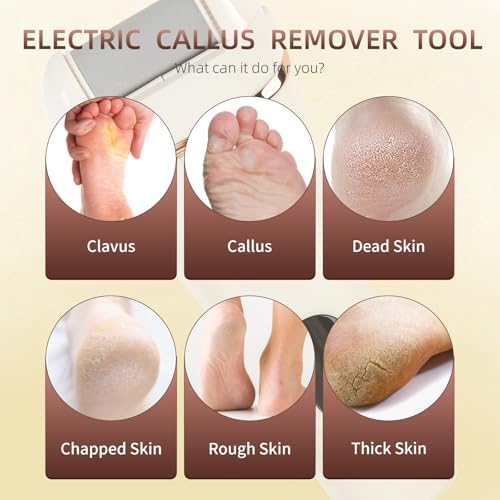Electric Callus Remover for Feet, 17-in-1 Professional Pedicure Kit, Foot Scrubber Electric Foot File for Hard Cracked Dry Dead Skin, 3 Rollers, 2 Speed, Battery Display