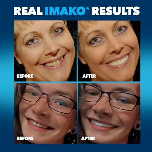 Imako Premium Cosmetic Uppers - 1 Pack - Large, Bleached White - Custom Fit at Home, DIY Smile Makeover, Made in USA