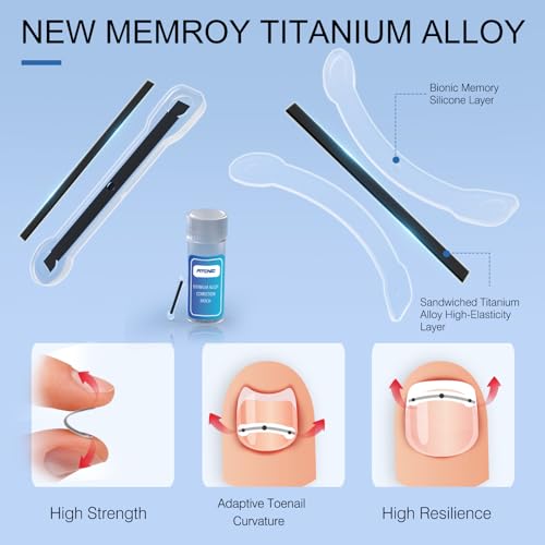 Titanium Alloy Ingrown Toenail Treatment, Ingrown Toenail Corrector Kit Specially Designed for Curved Nail Repair with Clip & Pusher & Protector Tool