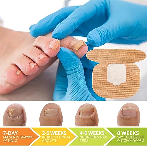 Toenail Fungus Treatment Extra Strength: (Large) 21 Patches with Hydrogel for Overnight Repair Fungus Nail Treatment For Toenail - Nighttime Nail Patches Visible Results in 8 Hours