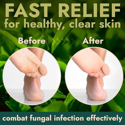 Foot Scrub with Tea Tree Oil | Callus Remover For Feet | Exfoliating Scrub with Salicylic and Glycolic Acid for Dead Skin, Athlete’s Foot, Warts, Corns, Rashes, Foot Odor, Insect Bites and Foot Care