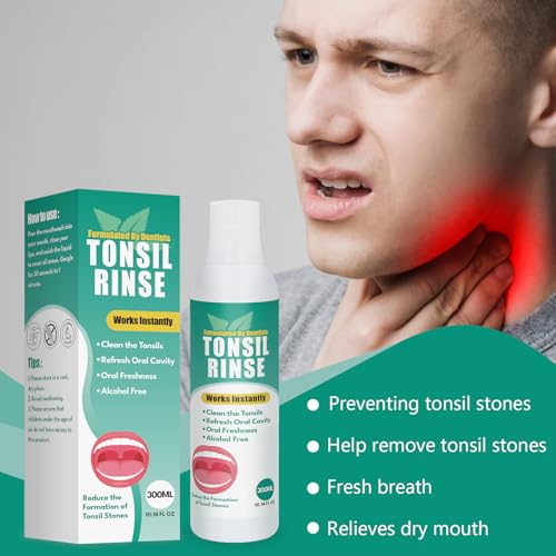 Tonsil Stone Remover with Oral Rinse Liquid to Soothe Tonsils, and Freshen Breath & Alcohol-Free – 300ml (10.14 fl oz)