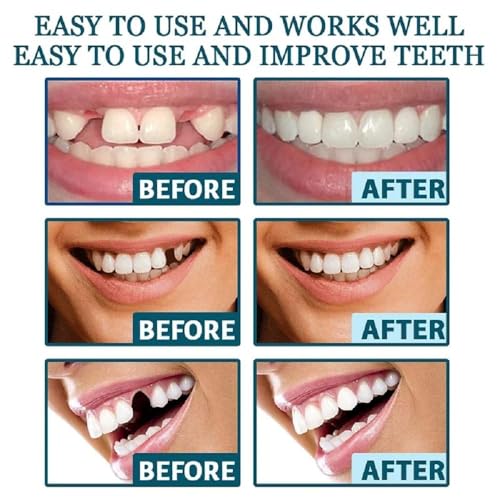 Tooth Repair Kit, Moldable Tooth Filling Repair Kit Beads with 3 Dental Tool, Moldable False Teeth Beads The Missing and Broken Replacements, DIY Natural Filling Fake Teeth,Smile Confidently Again