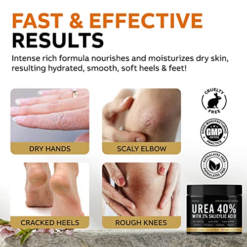 Urea Cream 40 Percent for Feet Maximum Strength, Urea Foot Cream for Dry Cracked Heels Feet Knees Elbows, 40% Urea Foot Repair Lotion 5.3 OZ