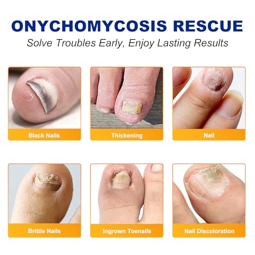 Toenail Treatment Extra Strength-8-Hrs Overnight Nail Repair,ingrown toenail treatment,Strengthens Brittle Nails,Improves Texture & Thickening Hypoallergenic Easy (2 pack 64 Patch)