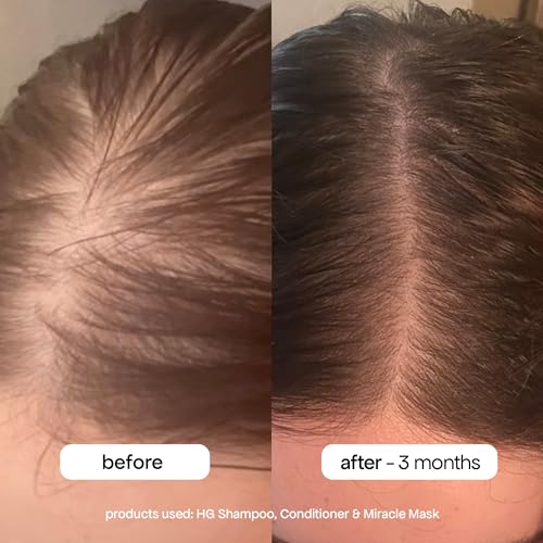 BONDIBOOST Miracle Hair Mask for Damaged Hair [8.45 fl oz], Deep Conditioning Hair Mask for Fine Hair, Clinically-Proven to Improve Split Ends, Argan Oil + Biotinoyl Tripeptide-1 Formula, Sulfate Free