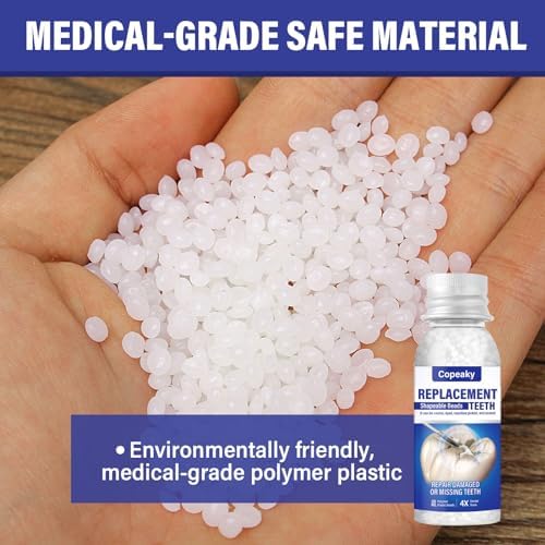 Tooth Repair Kit, Safe and Comfortable Replacements, Moldable Tooth Filling Repair Kit, Make You Smile Confidently Again (30mL)